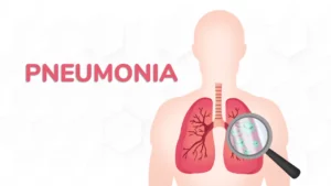 Penyebab Mycoplasma Pneumoniae dan Pneumonia Tipikal